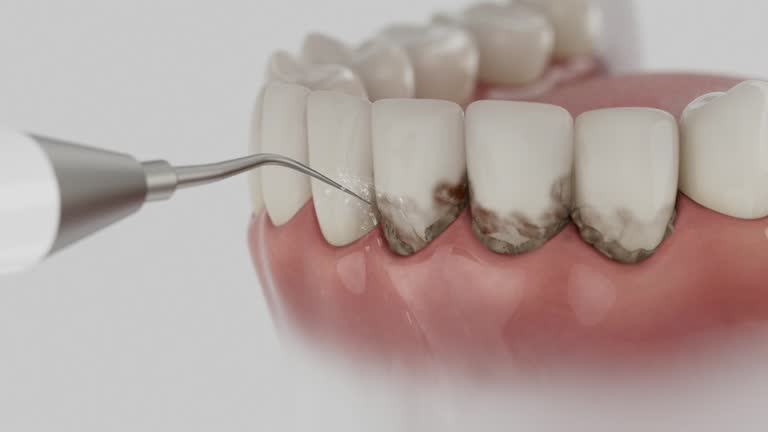 Trusted Dental Crowns And Bridges service in Prichard, AL - Dentist Open Now